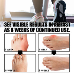 Anti-Bunions Health Sock,Foot heel care for sore heels warm breathable foot socks