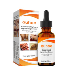 Skin Lightening Serum, Brightening Moisturizing Remove Black Skin Beauty Essence